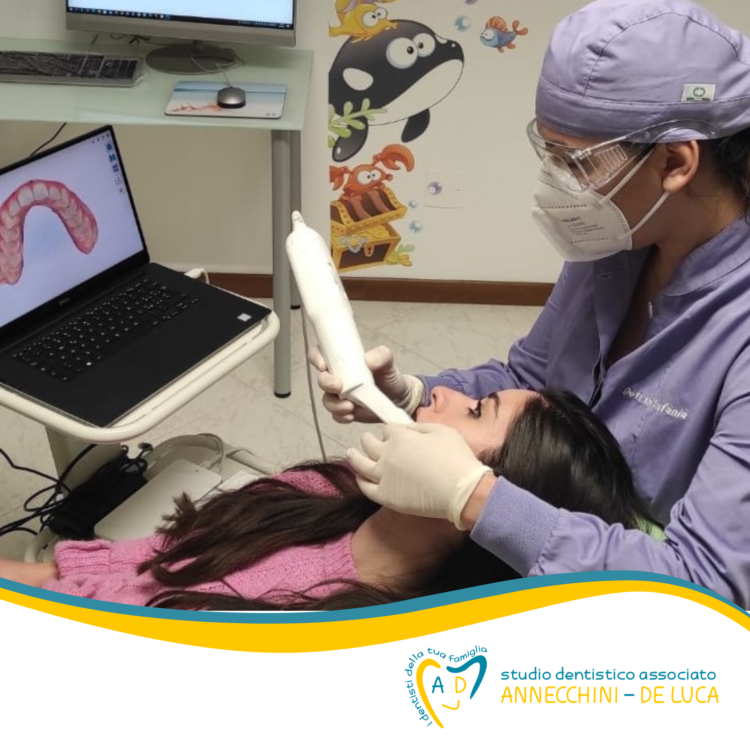 Scansione intraorale